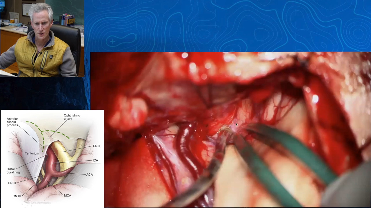 Episode 15 Part 1: Ophthalmic Artery Aneurysm  